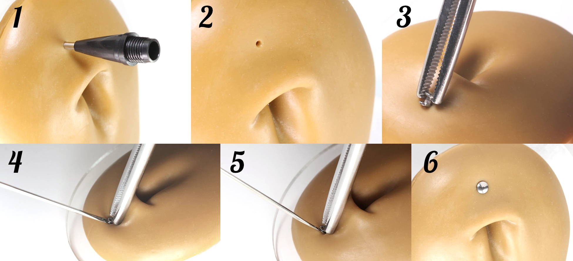 Outil assistant pour ancre dermal