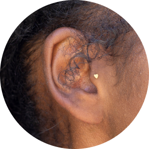 Category Tragus thumbnail.